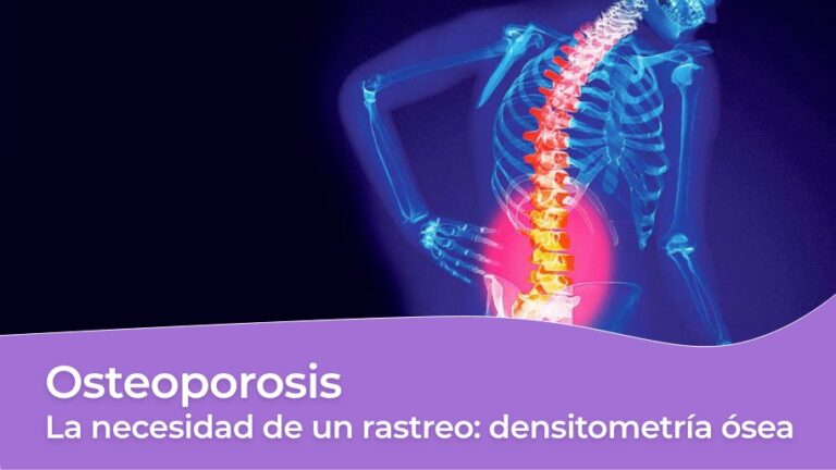 Osteoporosis - la necesidad de hacer un rastreo densitometría ósea
