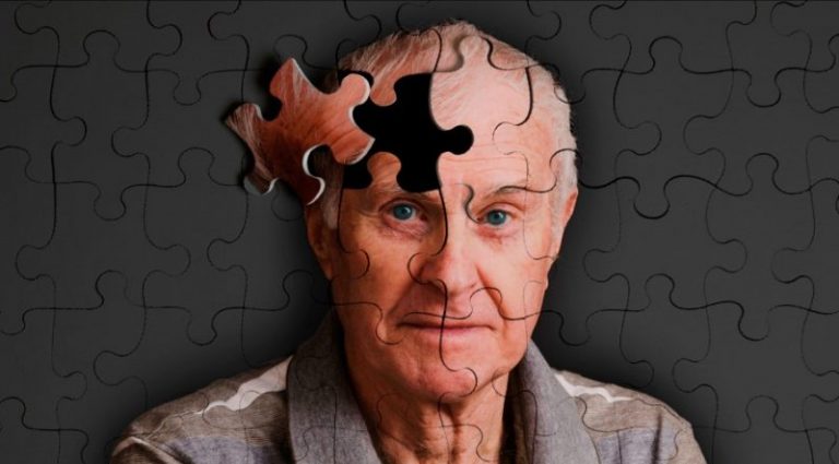 ¿Qué es el Alzheimer?