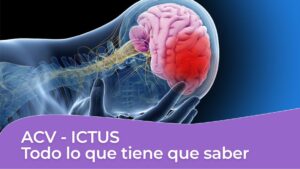 ACV-ICTUS-Derrame cerebral-todo lo que hay que saber apoplejía