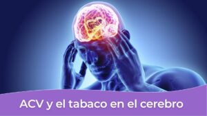 ACV y el tabaco en el cerebro