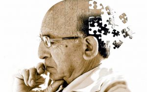 alzheimer