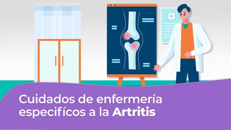 Cuidados de enfermería específicos para la Artritis Reumatoidea