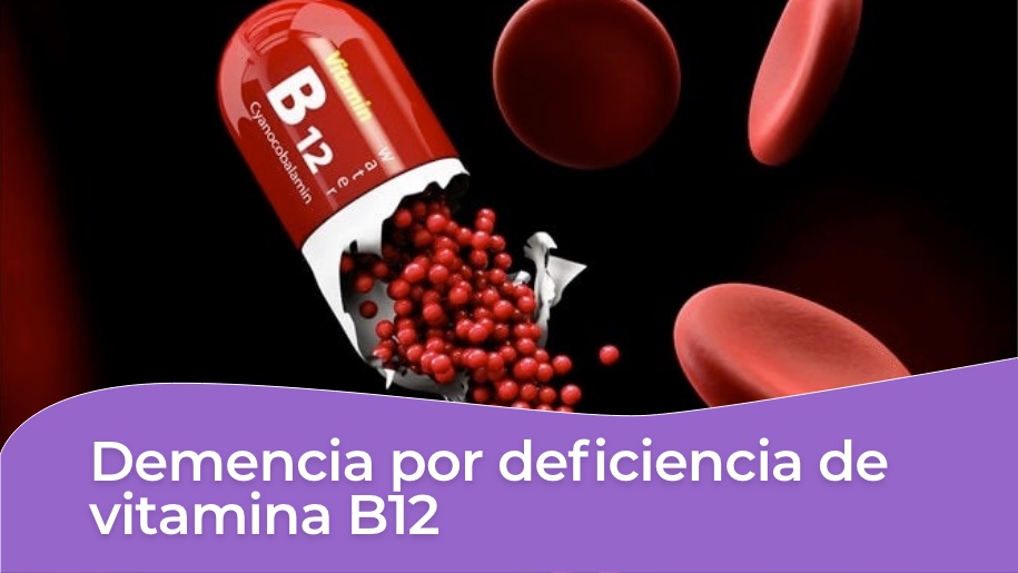 Demencia deficiencia de vitamina B12 en CABA